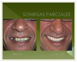 Slider image (7) Dr. Rojas Esthetique Dental Clinic